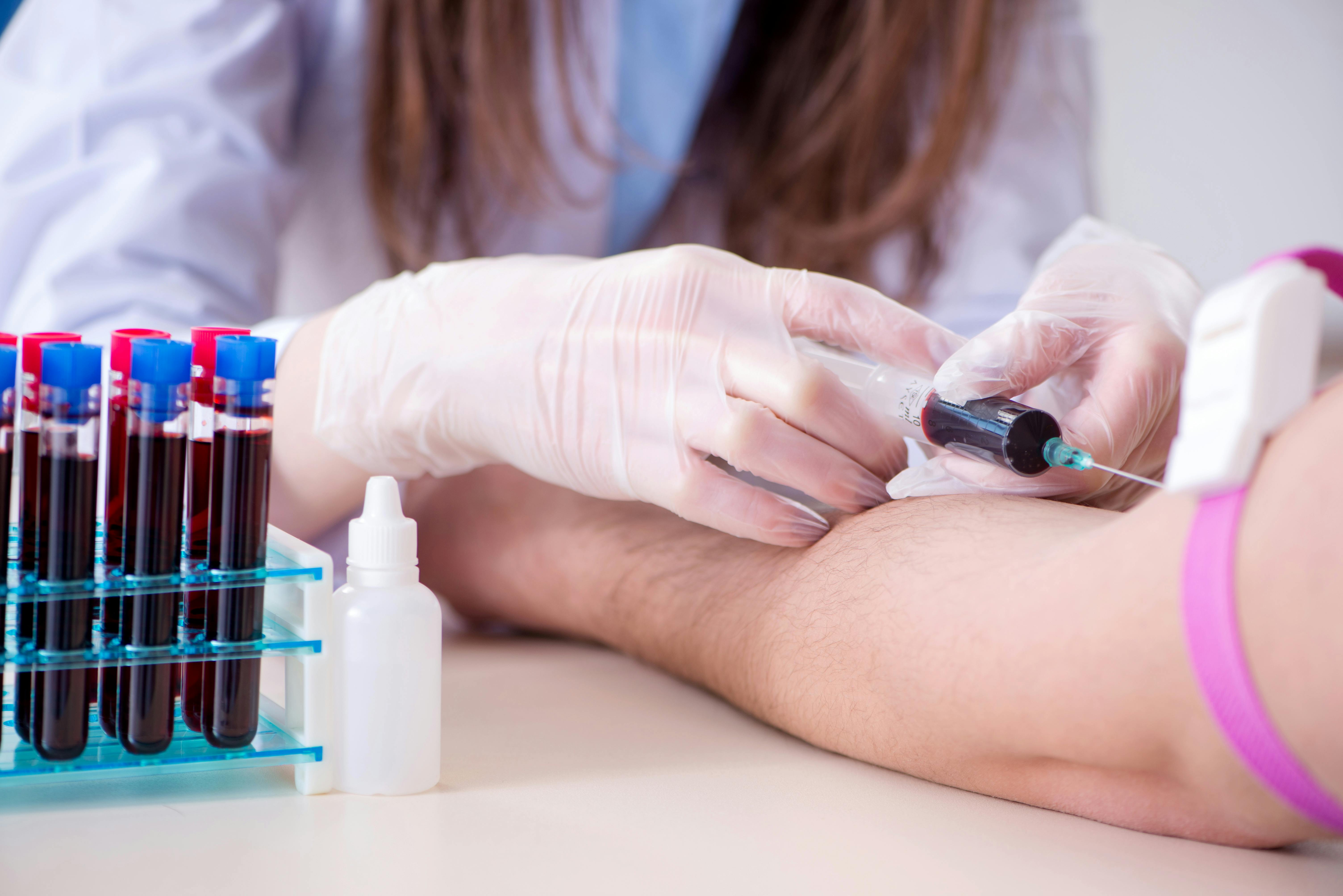 Patient during blood test sampling procedure taken for analysis