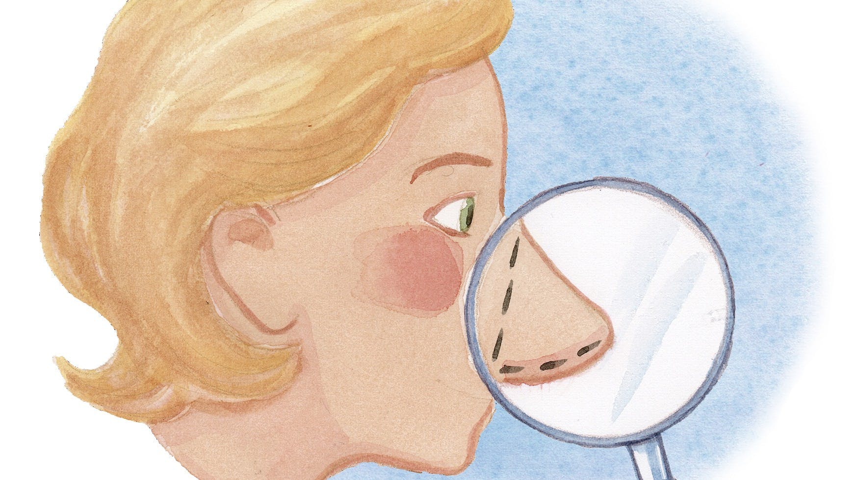 Person der vil have fikset sin næse.