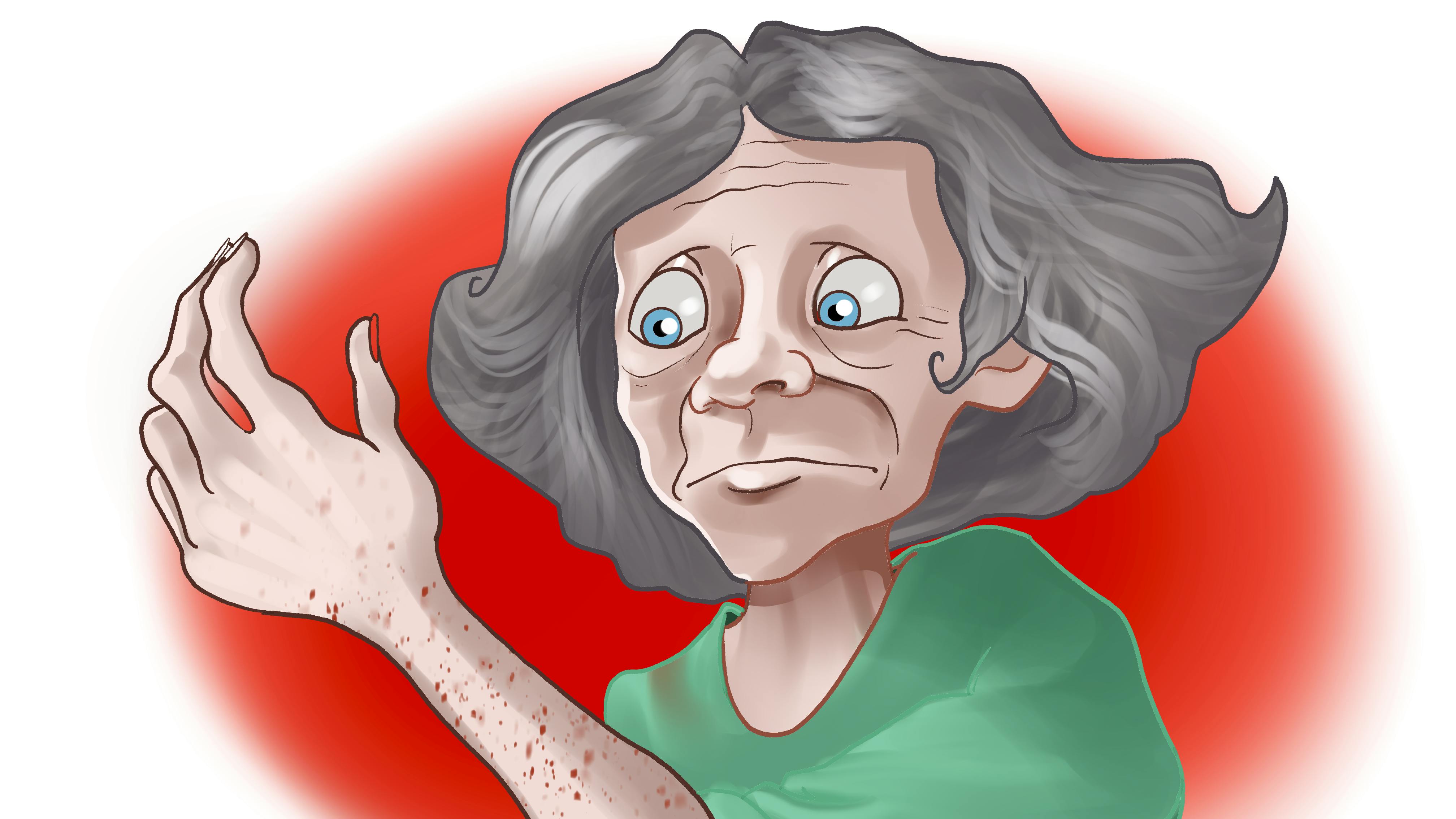 Kvinde kigger bekymret på sit udslæt