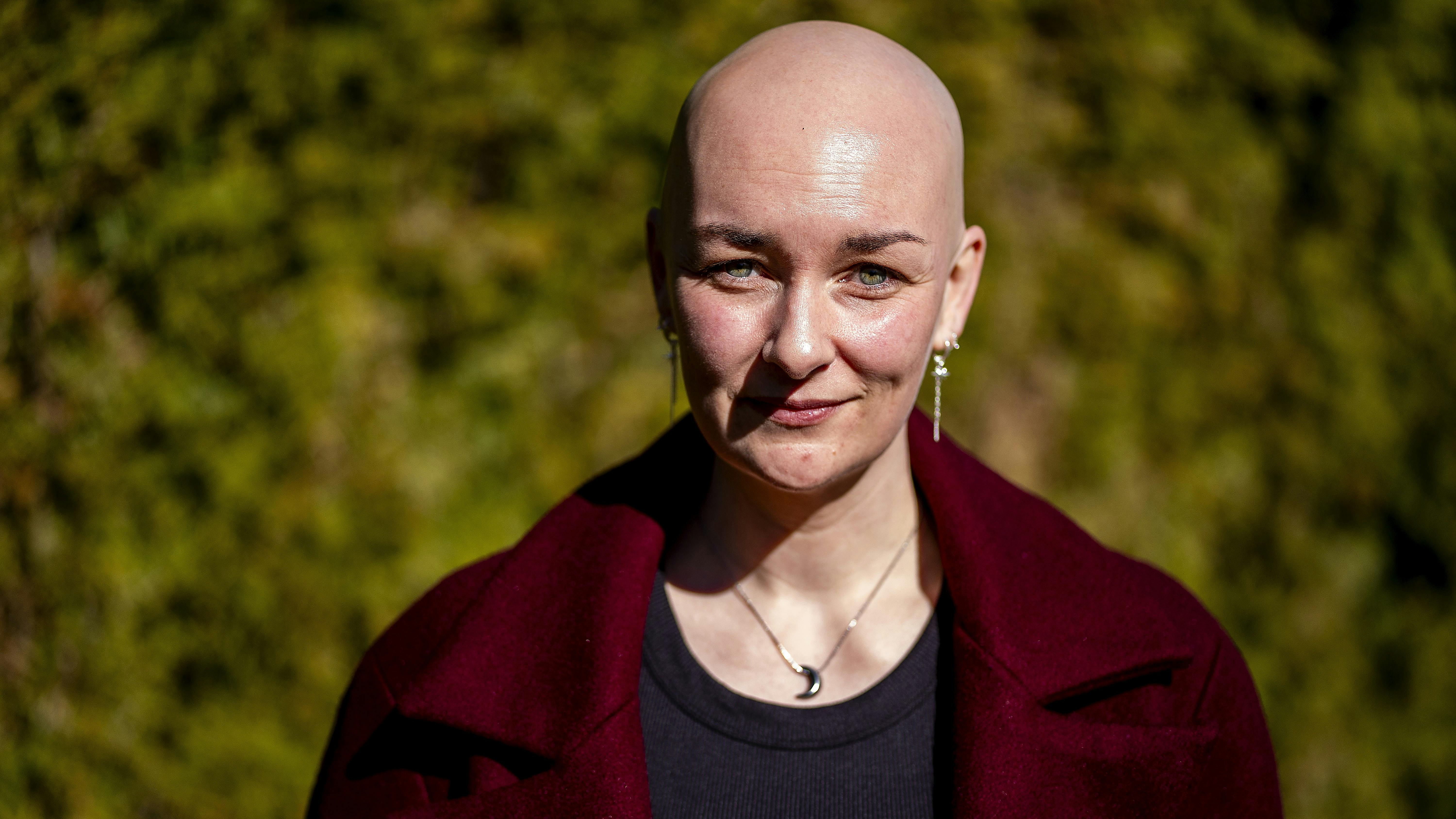 Kvinde uden hår, der smiler