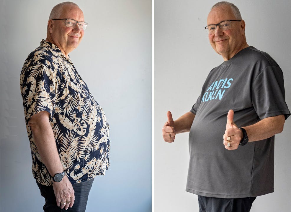 Johan Isbrand før og efter Kandiskuren