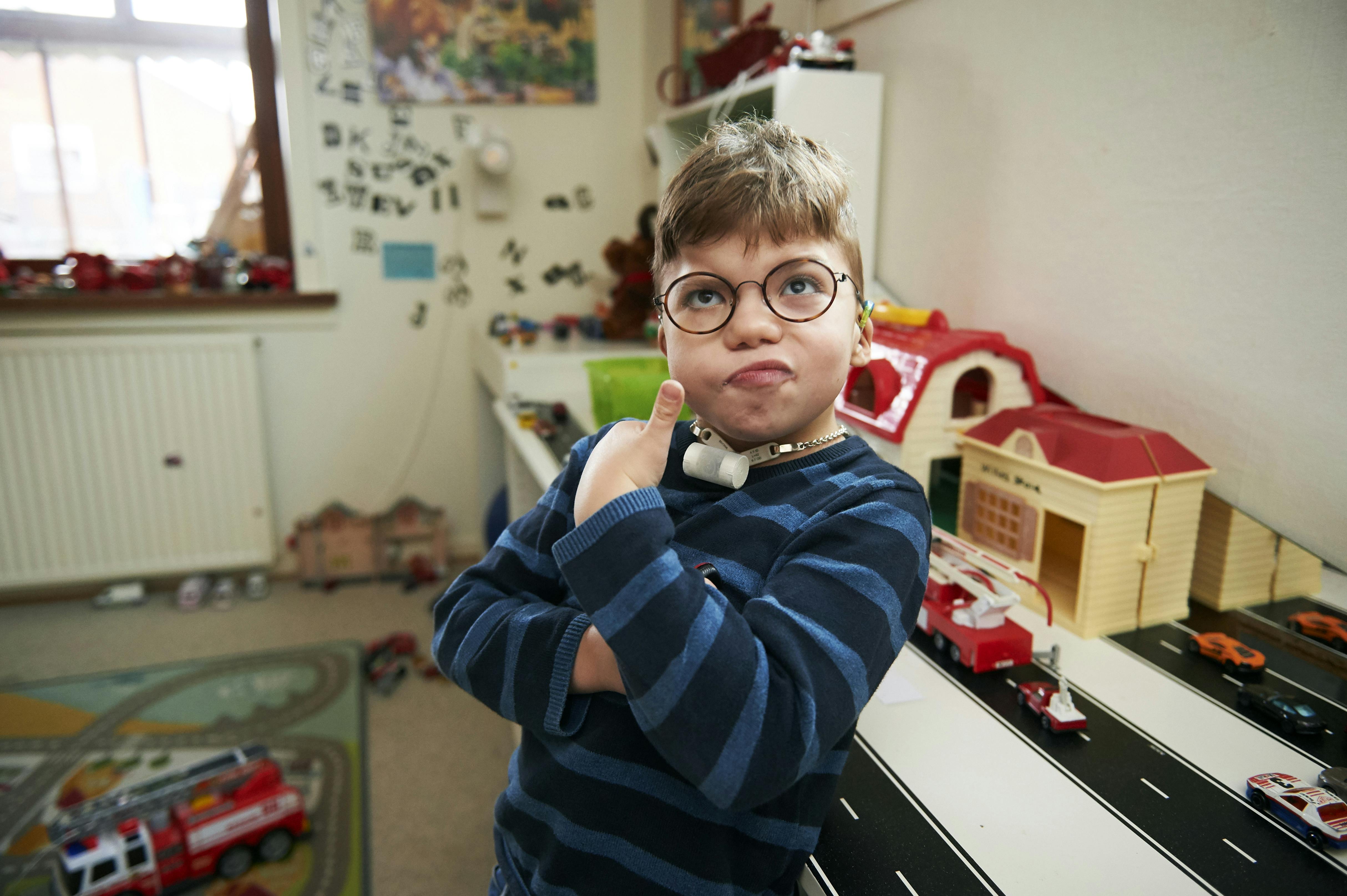 Willie har Charge syndrom