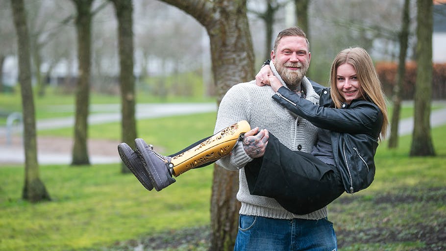 Maria blev født med kun ét ben: Viser stolt sit kunstige ben frem