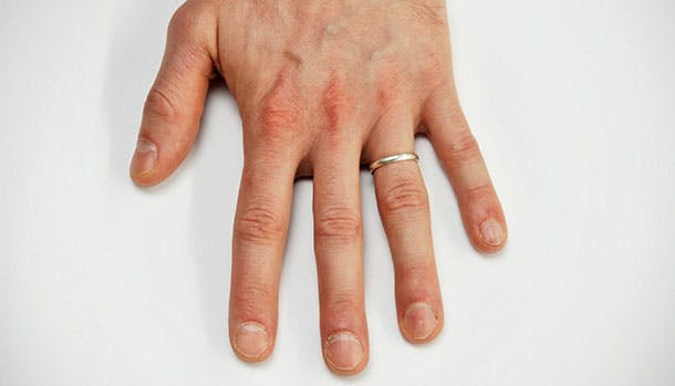 https://imgix.familiejournal.dk/media/article/negle.jpg