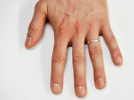 https://imgix.familiejournal.dk/media/article/negle.jpg
