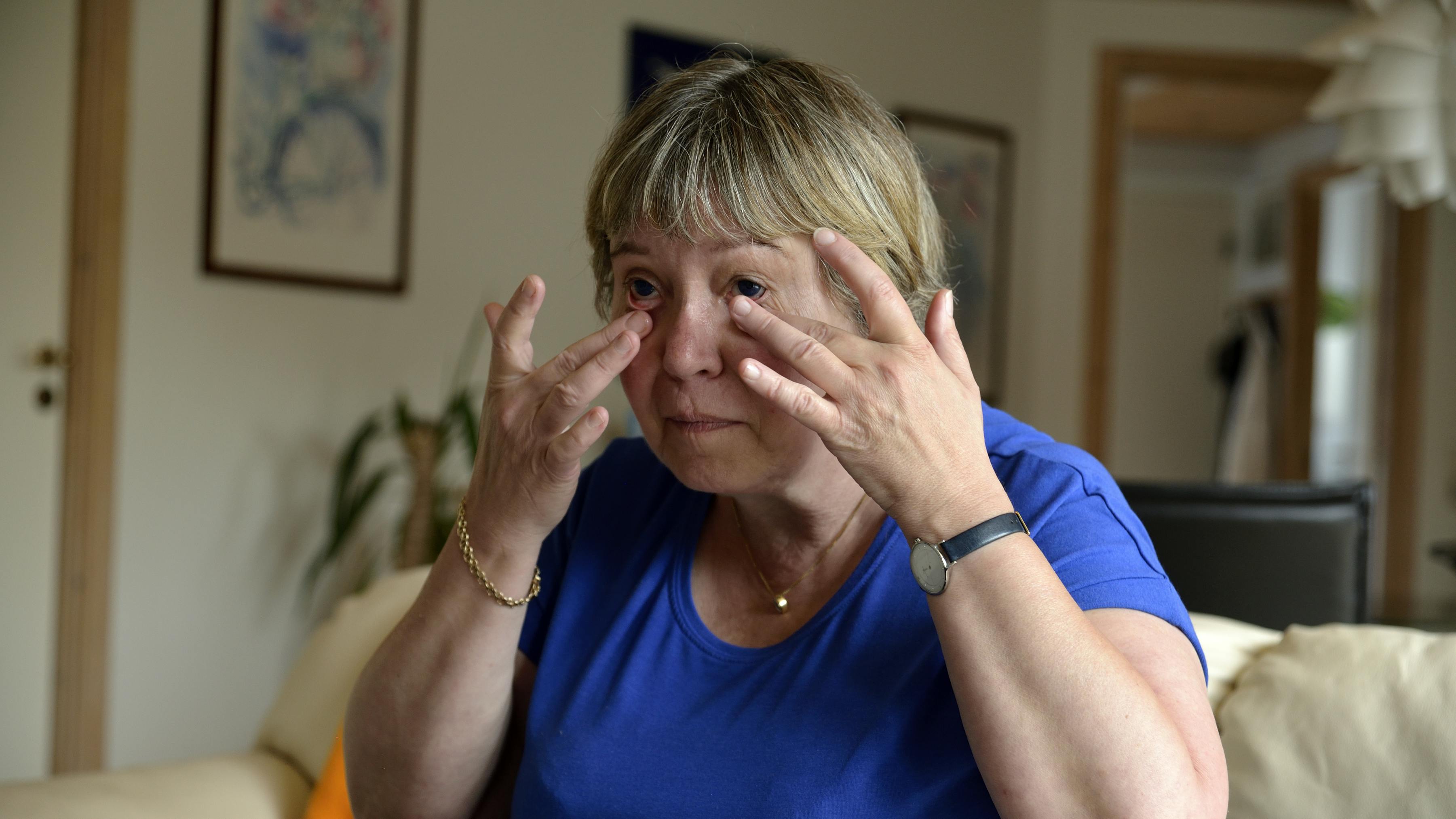 Susanne Rosita Meelbye lider af den sjældne øjensygdom Aniridi, der betyder, at hun blot har få procent syn på hvert øje.